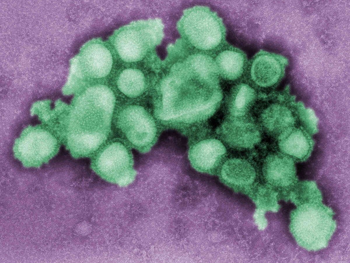 B00526-Swine flu
