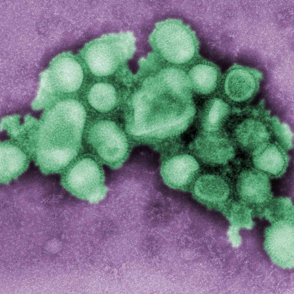 B00526-Swine flu